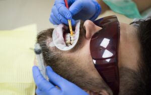 Koferdam w stomatologii – kiedy warto go stosować?